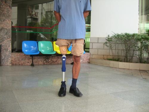 一個好的假肢廠家從哪些方面進(jìn)行評價(圖1)